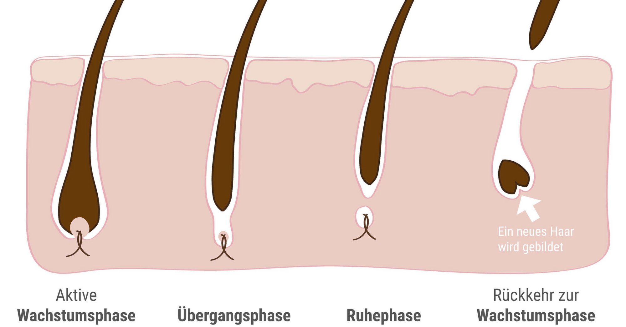 Haarausfall bei Frauen – Ursachen